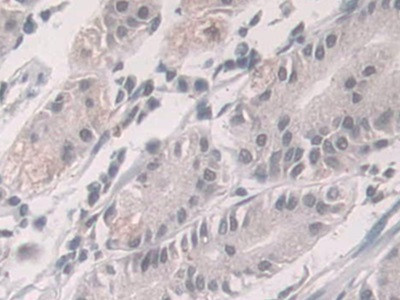 Glucocorticoid Receptor Antibody in Immunohistochemistry (Paraffin) (IHC (P))