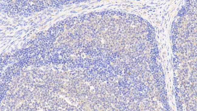 G6PD Antibody in Immunohistochemistry (Paraffin) (IHC (P))