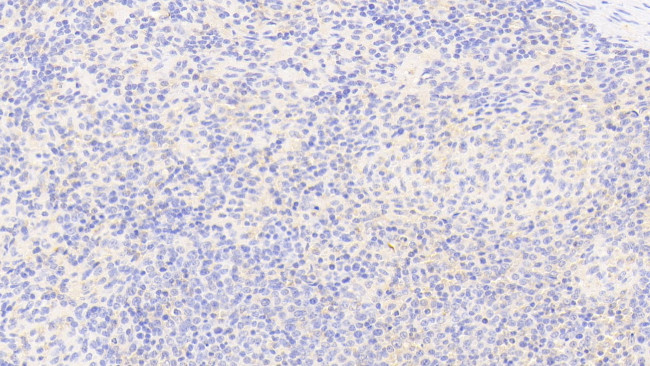 G6PD Antibody in Immunohistochemistry (Paraffin) (IHC (P))