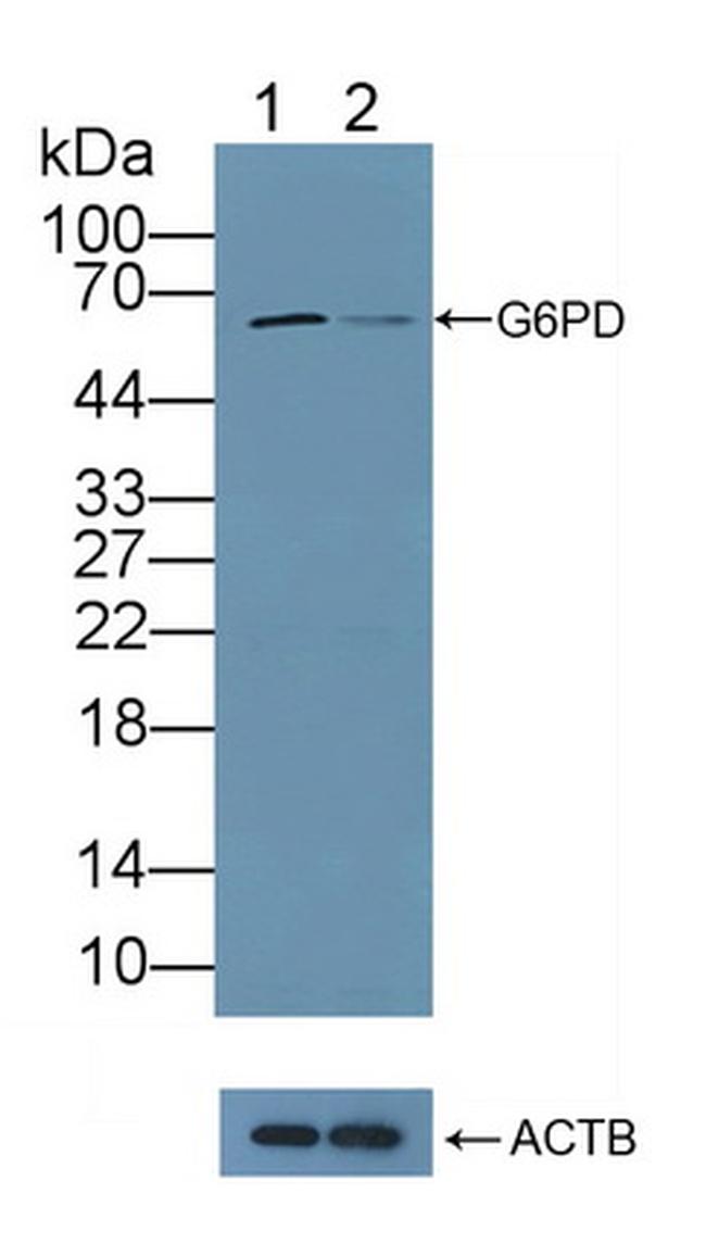 G6PD Antibody in Western Blot (WB)