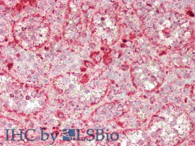 GUSB Antibody in Immunohistochemistry (Paraffin) (IHC (P))