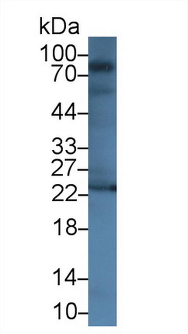 GUSB Antibody in Western Blot (WB)