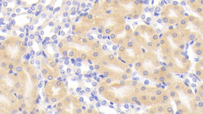 Glutaminase Antibody in Immunohistochemistry (Paraffin) (IHC (P))