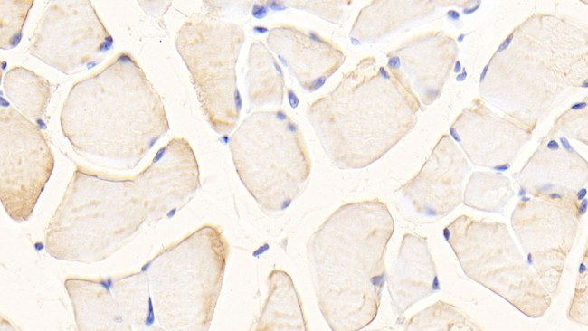 Glutaminase Antibody in Immunohistochemistry (Paraffin) (IHC (P))