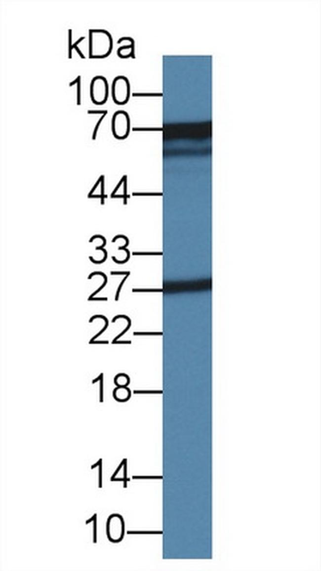 Glutaminase Antibody in Western Blot (WB)