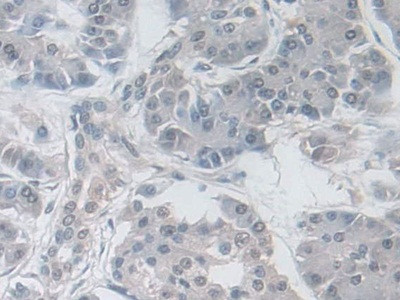 GPX3 Antibody in Immunohistochemistry (Paraffin) (IHC (P))