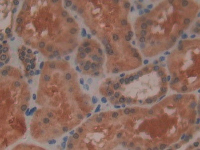 GPX4 Antibody in Immunohistochemistry (Paraffin) (IHC (P))