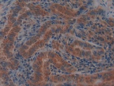 GPX4 Antibody in Immunohistochemistry (Paraffin) (IHC (P))