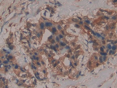 GPX4 Antibody in Immunohistochemistry (Paraffin) (IHC (P))