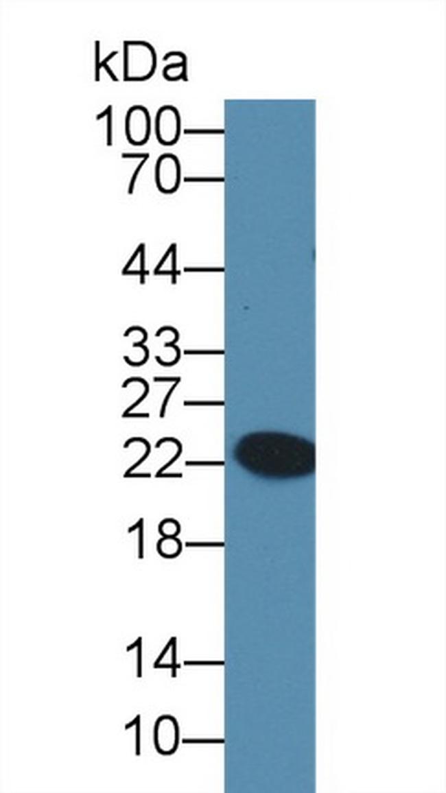 GPX6 Antibody in Western Blot (WB)