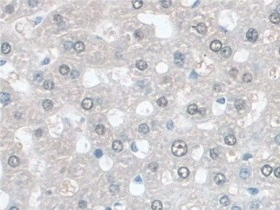 GSTM4 Antibody in Immunohistochemistry (Paraffin) (IHC (P))