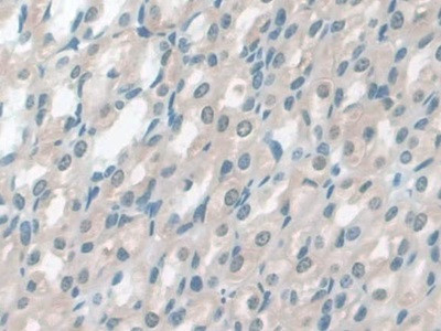 GSTM4 Antibody in Immunohistochemistry (Paraffin) (IHC (P))