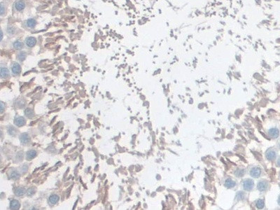 GSTM4 Antibody in Immunohistochemistry (Paraffin) (IHC (P))