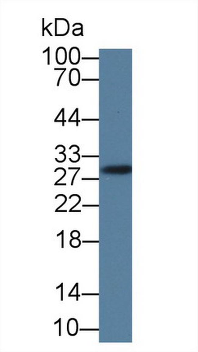 GSTM4 Antibody in Western Blot (WB)