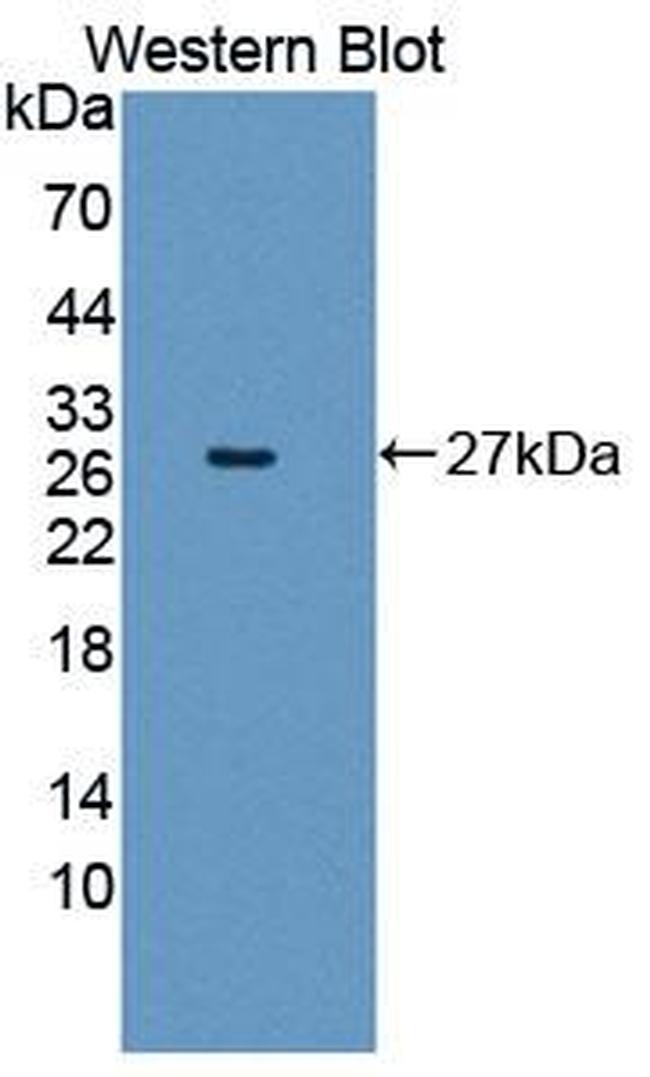 GSTM4 Antibody in Western Blot (WB)