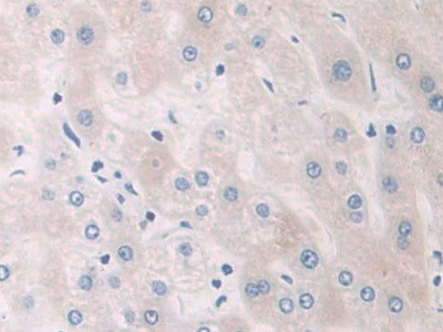 PYGB Antibody in Immunohistochemistry (Paraffin) (IHC (P))