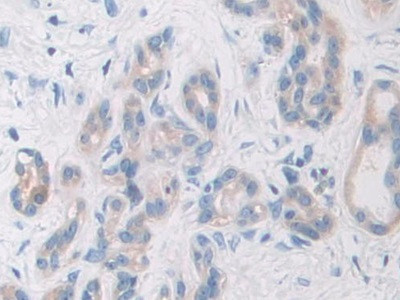 PYGB Antibody in Immunohistochemistry (Paraffin) (IHC (P))