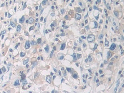 PYGB Antibody in Immunohistochemistry (Paraffin) (IHC (P))