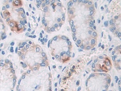 PYGB Antibody in Immunohistochemistry (Paraffin) (IHC (P))