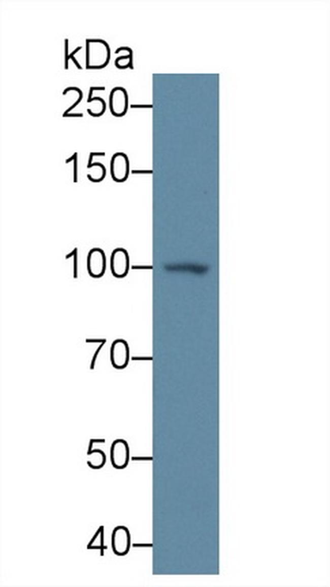 PYGB Antibody in Western Blot (WB)