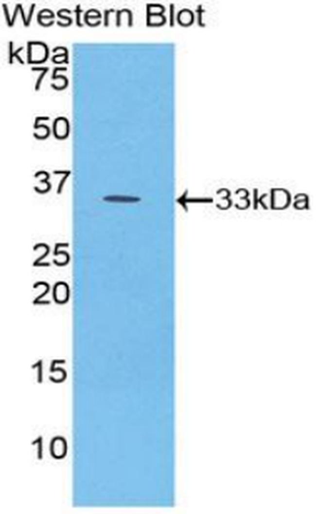 PYGB Antibody in Western Blot (WB)