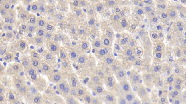 PYGL Antibody in Immunohistochemistry (Paraffin) (IHC (P))