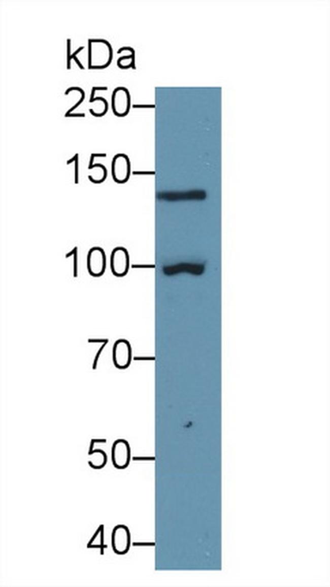 PYGL Antibody in Western Blot (WB)