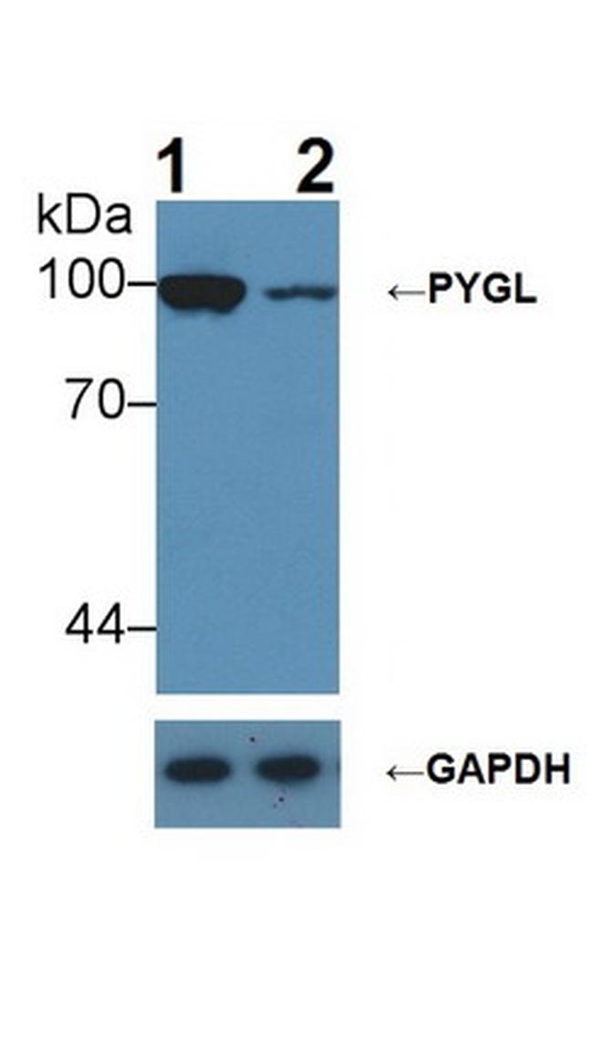 PYGL Antibody in Western Blot (WB)