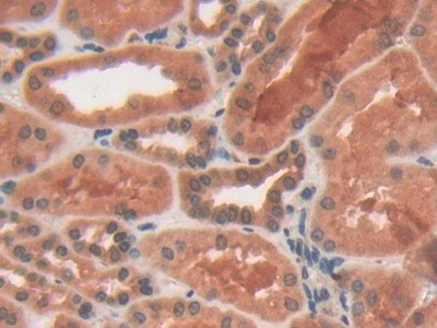 PYGL Antibody in Immunohistochemistry (Paraffin) (IHC (P))