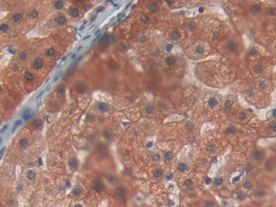 PYGL Antibody in Immunohistochemistry (Paraffin) (IHC (P))