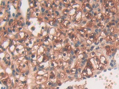 PYGL Antibody in Immunohistochemistry (Paraffin) (IHC (P))