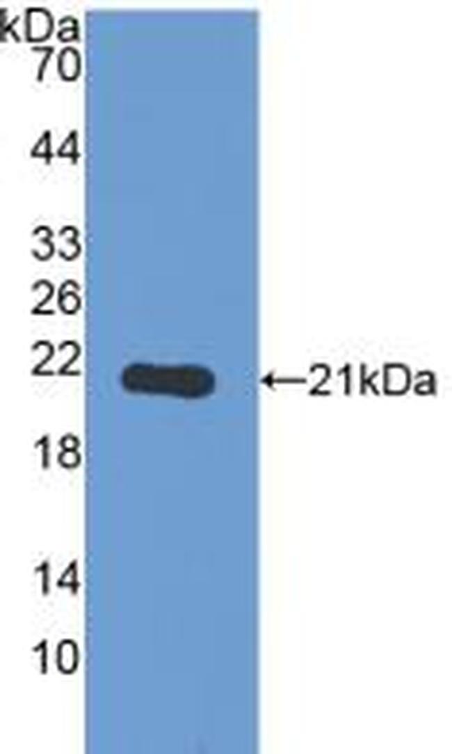 PYGL Antibody in Western Blot (WB)