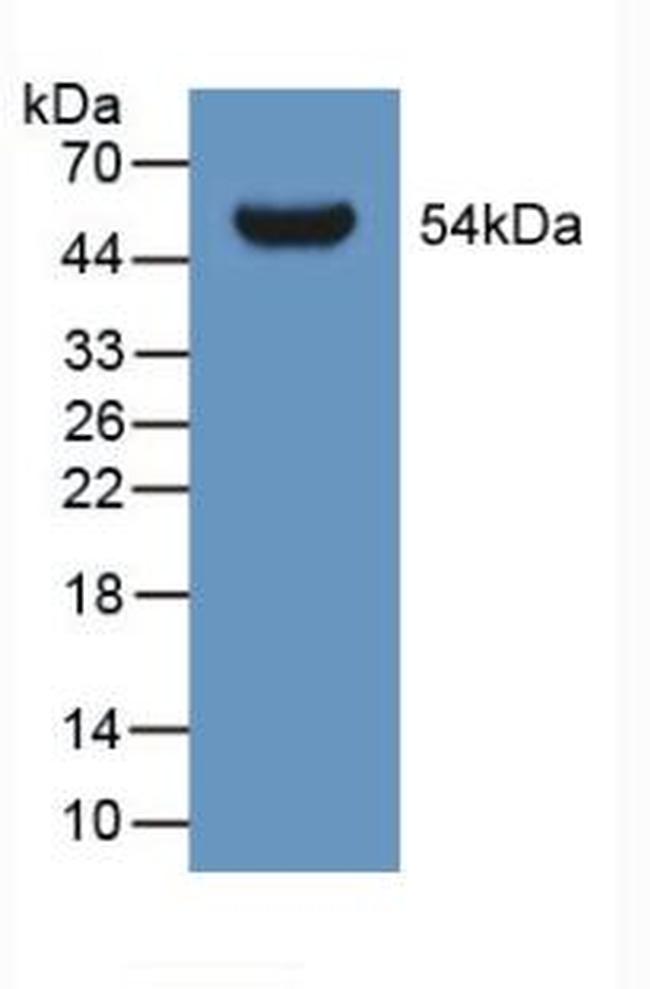 GLTP Antibody in Western Blot (WB)