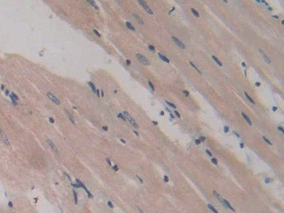 CD42a Antibody in Immunohistochemistry (Paraffin) (IHC (P))