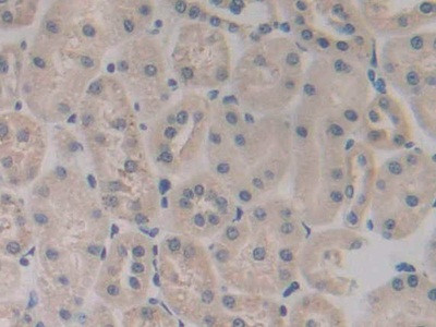 CD42a Antibody in Immunohistochemistry (Paraffin) (IHC (P))