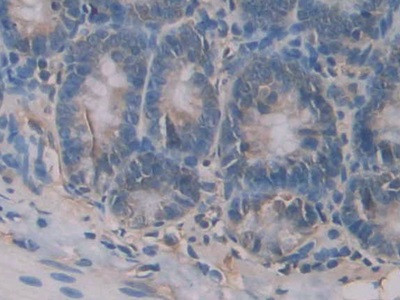 CD42a Antibody in Immunohistochemistry (Paraffin) (IHC (P))