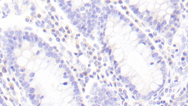 Granzyme M Antibody in Immunohistochemistry (Paraffin) (IHC (P))