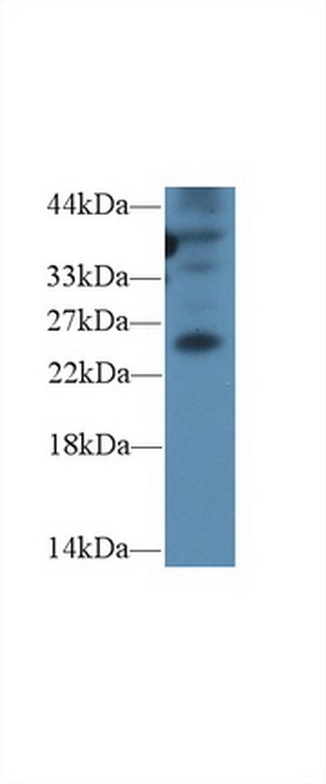GREM1 Antibody in Western Blot (WB)