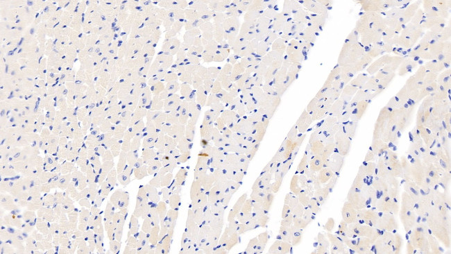 GDF1 Antibody in Immunohistochemistry (Paraffin) (IHC (P))