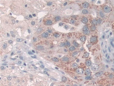 GRB10 Antibody in Immunohistochemistry (Paraffin) (IHC (P))