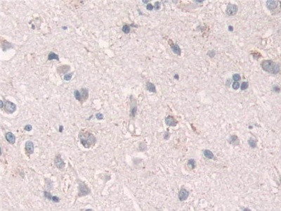 GRB10 Antibody in Immunohistochemistry (Paraffin) (IHC (P))