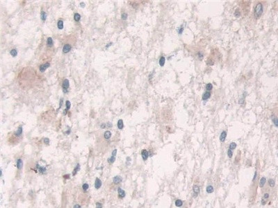 GRB10 Antibody in Immunohistochemistry (Paraffin) (IHC (P))