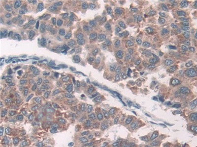 GRB10 Antibody in Immunohistochemistry (Paraffin) (IHC (P))