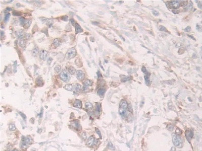 GRB10 Antibody in Immunohistochemistry (Paraffin) (IHC (P))