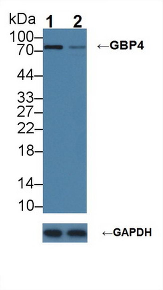 GBP4 Antibody in Western Blot (WB)