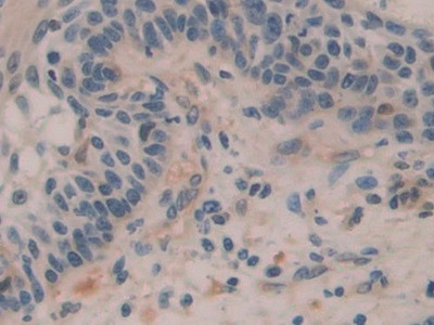 Histone Macro-H2A.1 Antibody in Immunohistochemistry (Paraffin) (IHC (P))