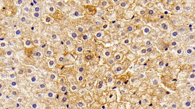 Haptoglobin Antibody in Immunohistochemistry (Paraffin) (IHC (P))