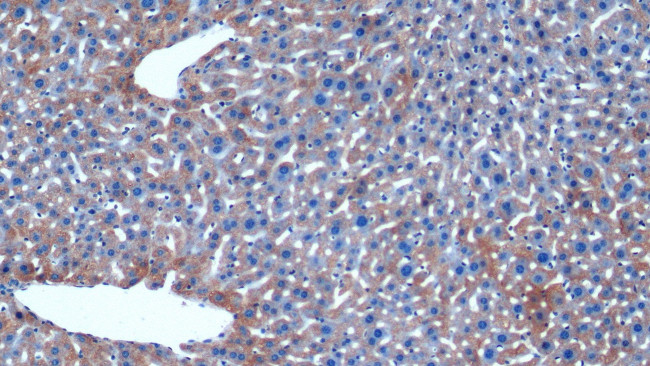 HAUS7 Antibody in Immunohistochemistry (Paraffin) (IHC (P))