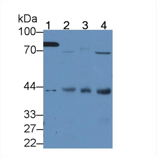 HAUS7 Antibody in Western Blot (WB)