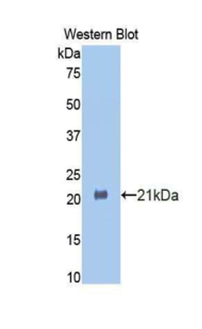 HSPBP1 Antibody in Western Blot (WB)